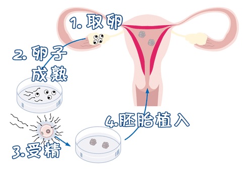 卵巢评估